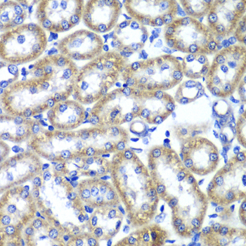 TMED10 / TMP21 Antibody - Immunohistochemistry of paraffin-embedded rat kidney tissue.
