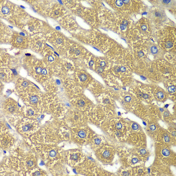 TMED10 / TMP21 Antibody - Immunohistochemistry of paraffin-embedded human liver injury tissue.