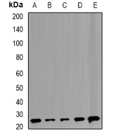TMED10 / TMP21 Antibody - Western blot analysis of TMP21 expression in Raji (A); HeLa (B); MCF7 (C); mouse liver (D); rat lung (E) whole cell lysates.