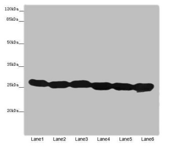 TMED10 / TMP21 Antibody - Western blot All Lanes: TMED10antibody at 4.88ug/ml Lane 1 : Hela whole cell lysate Lane 2 : Mouse liver tissue Lane 3 : Mouse lung tissue Lane 4 : 293T whole cell lysate Lane 5 : NIH/3T3 whole cell lysate Lane 6 : U87 whole cell lysate Secondary Goat polyclonal to Rabbit IgG at 1/10000 dilution Predicted band size: 25 kDa Observed band size: 25 kDa