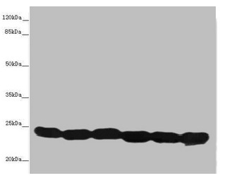 TMED10 / TMP21 Antibody - Western blot All lanes: TMED10 antibody at 4.88µg/ml Lane 1: Hela whole cell lysate Lane 2: Mouse liver tissue Lane 3: Mouse lung tissue Lane 4: 293T whole cell lysate Lane 5: NIH/3T3 whole cell lysate Lane 6: U87 whole cell lysate Secondary Goat polyclonal to rabbit IgG at 1/10000 dilution Predicted band size: 25 kDa Observed band size: 25 kDa