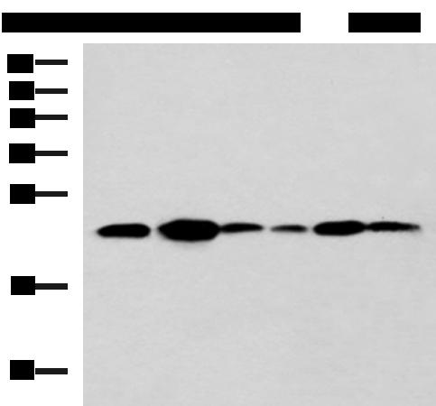TMED10 / TMP21 Antibody - Western blot analysis of NIH/3T3 cell Mouse Pancreas tissue Rat lung tissue Mouse liver tissue Hela Raji cell lysates  using TMED10 Polyclonal Antibody at dilution of 1:900