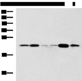 TMED10 / TMP21 Antibody - Western blot analysis of Raji Hela cell Mouse liver tissue Rat lung tissue Mouse Pancreas tissue NIH/3T3 cell lysates  using TMED10 Polyclonal Antibody at dilution of 1:800