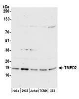 TMED2 Antibody - Detection of human and mouse TMED2 by western blot. Samples: Whole cell lysate (15 µg) from HeLa, HEK293T, Jurkat, mouse TCMK-1, and mouse NIH 3T3 cells prepared using NETN lysis buffer. Antibody: Affinity purified rabbit anti-TMED2 antibody used for WB at 0.1 µg/ml. Detection: Chemiluminescence with an exposure time of 30 seconds.