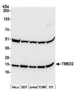 TMED2 Antibody - Detection of human and mouse TMED2 by western blot. Samples: Whole cell lysate (50 µg) from HeLa, HEK293T, Jurkat, mouse TCMK-1, and mouse NIH 3T3 cells prepared using NETN lysis buffer. Antibody: Affinity purified rabbit anti-TMED2 antibody used for WB at 0.4 µg/ml. Detection: Chemiluminescence with an exposure time of 10 seconds.