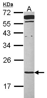 TMED2 Antibody - Sample (30 ug of whole cell lysate). A: Raji. 12% SDS PAGE. TMED2 antibody diluted at 1:1000.