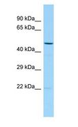 TMED2 Antibody - TMED2 antibody Western Blot of Placenta.  This image was taken for the unconjugated form of this product. Other forms have not been tested.