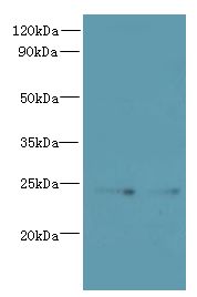 TMED2 Antibody - Western blot. All lanes: TMED2 antibody at 6 ug/ml. Lane 1: HCT116 whole cell lysate. Lane 2: Mouse Ovarian tissue. Secondary Goat polyclonal to Rabbit IgG at 1:10000 dilution. Predicted band size: 23 kDa. Observed band size: 23 kDa.