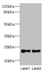 TMED2 Antibody - Western blot All lanes: TMED2 antibody at 6µg/ml Lane 1: HCT116 whole cell lysate Lane 2: Mouse Ovarian tissue Secondary Goat polyclonal to rabbit IgG at 1/10000 dilution Predicted band size: 23 kDa Observed band size: 23 kDa