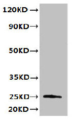 TMED3 Antibody - Western blot All lanes: TMED3 antibody at 6µg/ml + MCF-7 whole cell lysate Secondary Goat polyclonal to rabbit IgG at 1/10000 dilution Predicted band size: 25, 20 kDa Observed band size: 25 kDa