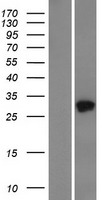 TMED5 Protein - Western validation with an anti-DDK antibody * L: Control HEK293 lysate R: Over-expression lysate