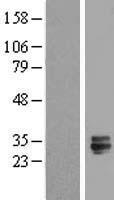 TMED6 Protein - Western validation with an anti-DDK antibody * L: Control HEK293 lysate R: Over-expression lysate