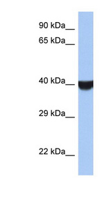TMED8 Antibody - TMED8 antibody Western blot of Jurkat lysate. This image was taken for the unconjugated form of this product. Other forms have not been tested.