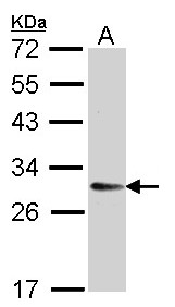 TMED9 Antibody - Sample (30 ug of whole cell lysate). A: H1299. 12% SDS PAGE. TMED9 antibody diluted at 1:5000.