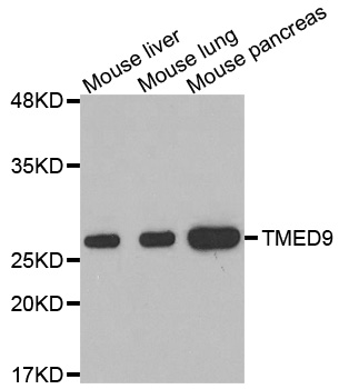 TMED9 Antibody - Western blot analysis of extracts of various cell lines, using TMED9 antibody.
