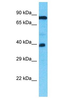 TMEFF1 / Tomoregulin 1 Antibody - TMEFF1 antibody Western Blot of 786-0. Antibody dilution: 1 ug/ml.  This image was taken for the unconjugated form of this product. Other forms have not been tested.