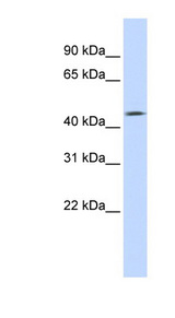 TMEFF1 / Tomoregulin 1 Antibody - TMEFF1 antibody Western blot of Fetal Heart lysate. This image was taken for the unconjugated form of this product. Other forms have not been tested.