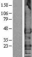 TMEFF1 / Tomoregulin 1 Protein - Western validation with an anti-DDK antibody * L: Control HEK293 lysate R: Over-expression lysate