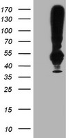 TMEFF2 Antibody - HEK293T cells were transfected with the pCMV6-ENTRY control (Left lane) or pCMV6-ENTRY TMEFF2 (Right lane) cDNA for 48 hrs and lysed. Equivalent amounts of cell lysates (5 ug per lane) were separated by SDS-PAGE and immunoblotted with anti-TMEFF2.