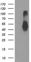TMEFF2 Antibody - HEK293T cells were transfected with the pCMV6-ENTRY control (Left lane) or pCMV6-ENTRY TMEFF2 (Right lane) cDNA for 48 hrs and lysed. Equivalent amounts of cell lysates (5 ug per lane) were separated by SDS-PAGE and immunoblotted with anti-TMEFF2.