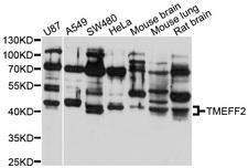 TMEFF2 Antibody - Western blot analysis of extracts of various cell lines, using TMEFF2 antibody at 1:1000 dilution. The secondary antibody used was an HRP Goat Anti-Rabbit IgG (H+L) at 1:10000 dilution. Lysates were loaded 25ug per lane and 3% nonfat dry milk in TBST was used for blocking. An ECL Kit was used for detection and the exposure time was 10s.