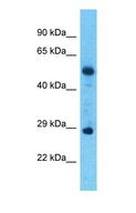 TMEM1 / TRAPPC10 Antibody - Western blot of TRAPPC10 Antibody with Esophagus Tumor lysate.  This image was taken for the unconjugated form of this product. Other forms have not been tested.