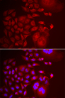 TMEM1 / TRAPPC10 Antibody - Immunofluorescence analysis of U2OS cells.