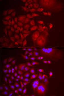 TMEM1 / TRAPPC10 Antibody - Immunofluorescence analysis of U2OS cells.