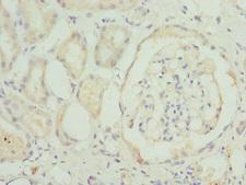 TMEM1 / TRAPPC10 Antibody - Immunohistochemistry of paraffin-embedded human kidney tissue at dilution 1:100