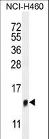 TMEM100 Antibody - TMEM100 Antibody western blot of NCI-H460 cell line lysates (35 ug/lane). The TMEM100 antibody detected the TMEM100 protein (arrow).