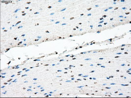 TMEM100 Antibody - IHC of paraffin-embedded colon tissue using anti-TMEM100 mouse monoclonal antibody. (Dilution 1:50).