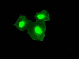TMEM100 Antibody - Anti-TMEM100 mouse monoclonal antibody  immunofluorescent staining of COS7 cells transiently transfected by pCMV6-ENTRY TMEM100.
