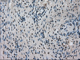 TMEM100 Antibody - IHC of paraffin-embedded Ovary tissue using anti-TMEM100 mouse monoclonal antibody. (Dilution 1:50).