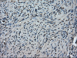 TMEM100 Antibody - IHC of paraffin-embedded endometrium tissue using anti-TMEM100 mouse monoclonal antibody. (Dilution 1:50).