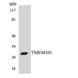 TMEM101 Antibody - Western blot analysis of the lysates from HepG2 cells using TMEM101 antibody.