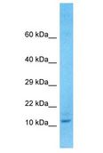 TMEM105 Antibody - TMEM105 antibody Western Blot of OVCAR-3. Antibody dilution: 1 ug/ml.  This image was taken for the unconjugated form of this product. Other forms have not been tested.