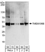 TMEM106B Antibody - Detection of Human and Mouse TMEM106B by Western Blot. Samples : Whole cell lysate from Jurkat (15 and 50 ug), 293T (T; 50 ug), HeLa (H; 50 ug) and mouse NIH3T3 (M; 50 ug) cells. Antibody : Affinity purified rabbit anti-TMEM106B antibody used for WB at 0.1 ug/ml. Detection: Chemiluminescence with an exposure time of 3 minutes.
