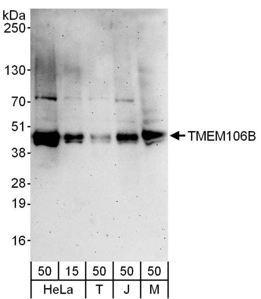TMEM106B Antibody - Detection of Human and Mouse TMEM106B by Western Blot. Samples : Whole cell lysate from Jurkat (15 and 50 ug), 293T (T; 50 ug), HeLa (H; 50 ug) and mouse NIH3T3 (M; 50 ug) cells. Antibody : Affinity purified rabbit anti-TMEM106B antibody used for WB at 0.1 ug/ml. Detection: Chemiluminescence with an exposure time of 3 minutes.