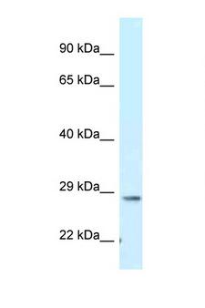 TMEM106B Antibody - TMEM106B antibody Western blot of Mouse Brain lysate. Antibody concentration 1 ug/ml.  This image was taken for the unconjugated form of this product. Other forms have not been tested.