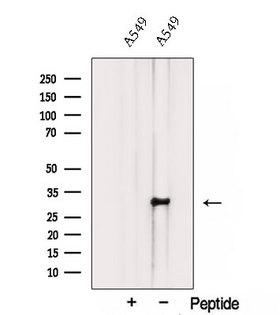 TMEM106B Antibody - Western blot analysis of extracts of A549 cells using TMEM106B antibody. The lane on the left was treated with blocking peptide.