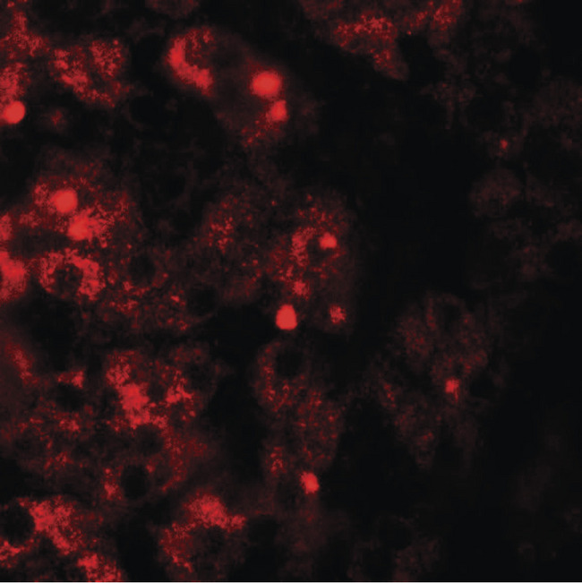 TMEM106B Antibody - Immunofluorescence of TMEM106B in human liver tissue with TMEM106A antibody at 20 ug/ml.