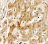 TMEM106B Antibody - Immunohistochemistry of TMEM106B in human liver tissue with TMEM106B antibody at 2.5 ug/ml.