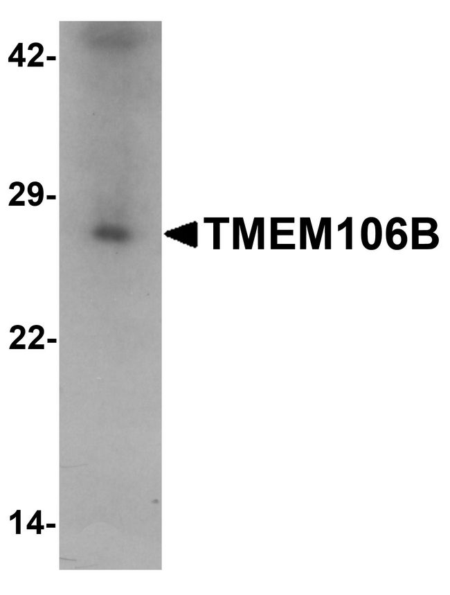 TMEM106B Antibody - Western blot analysis of TMEM106B in human liver tissue lysate with TMEM106B antibody at 1 ug/ml.