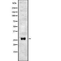 TMEM106C Antibody - Western blot analysis of T106C expression in HEK293 cells. The lane on the left is treated with the antigen-specific peptide.
