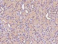 TMEM106C Antibody - Immunochemical staining of human TMEM106C in human kidney with rabbit polyclonal antibody at 1:100 dilution, formalin-fixed paraffin embedded sections.