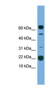 TMEM107 Antibody - TMEM107 antibody Western blot of THP-1 cell lysate. This image was taken for the unconjugated form of this product. Other forms have not been tested.