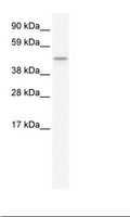 TMEM108 Antibody - Brain Lysate.  This image was taken for the unconjugated form of this product. Other forms have not been tested.