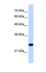 TMEM109 Antibody - Jurkat cell lysate. Antibody concentration: 1.25 ug/ml. Gel concentration: 12%.  This image was taken for the unconjugated form of this product. Other forms have not been tested.