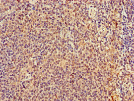 TMEM11 Antibody - Immunohistochemistry of paraffin-embedded human lymph node tissue at dilution of 1:100