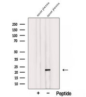 TMEM11 Antibody - Western blot analysis of extracts of mouse placenta tissue using TMEM11 antibody. The lane on the left was treated with blocking peptide.